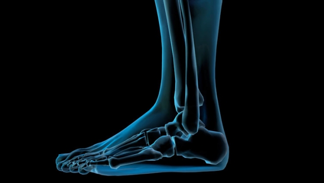 Häufige Fußbeschwerden: Hallux Valgus, Knick-Senkfuß &amp; Morton Neurom